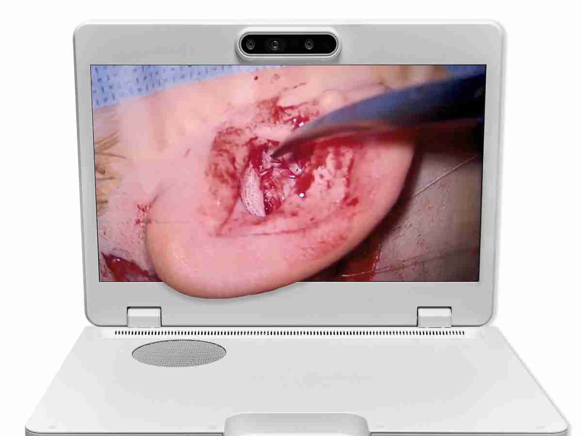 达擎之＂Heads-up 3D显微手术显示系统＂，，，，整合4K裸眼3D显示及眼球追踪系统，，，具备快速追踪人眼移动位置功能，，，减轻医师长时间维持固定姿势的负担，，，让医师能有更宽广清晰的3D立体视野及更舒适的姿势来执行手术。。。